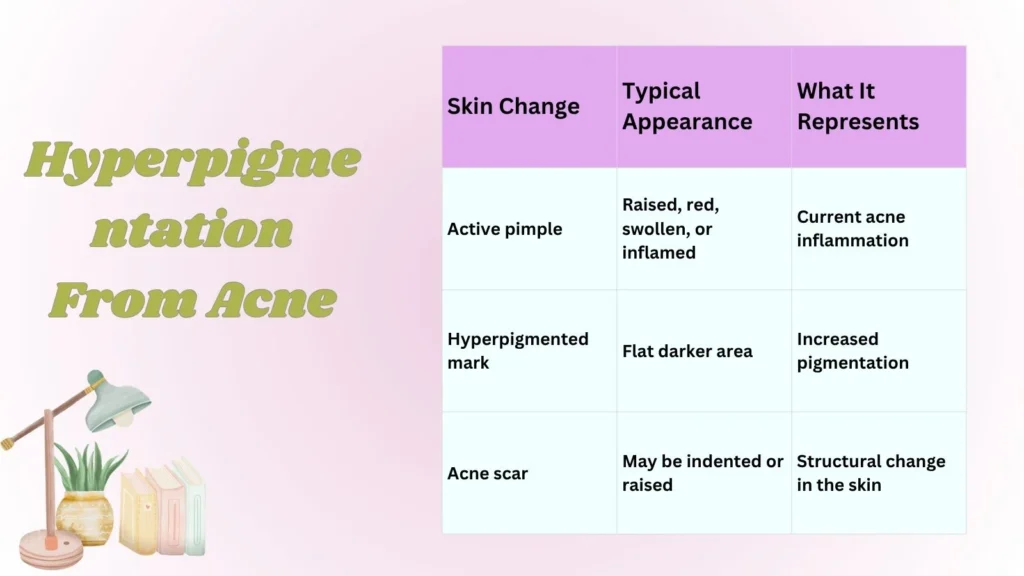 Hyperpigmentation From Acne